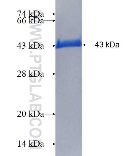 RAB2B fusion protein Ag2352 SDS-PAGE
