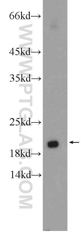 Western Blot (WB) analysis of HeLa cells using RAB30 Polyclonal antibody (16328-1-AP)