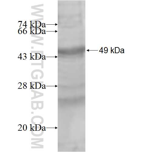 RAB30 fusion protein Ag9444 SDS-PAGE