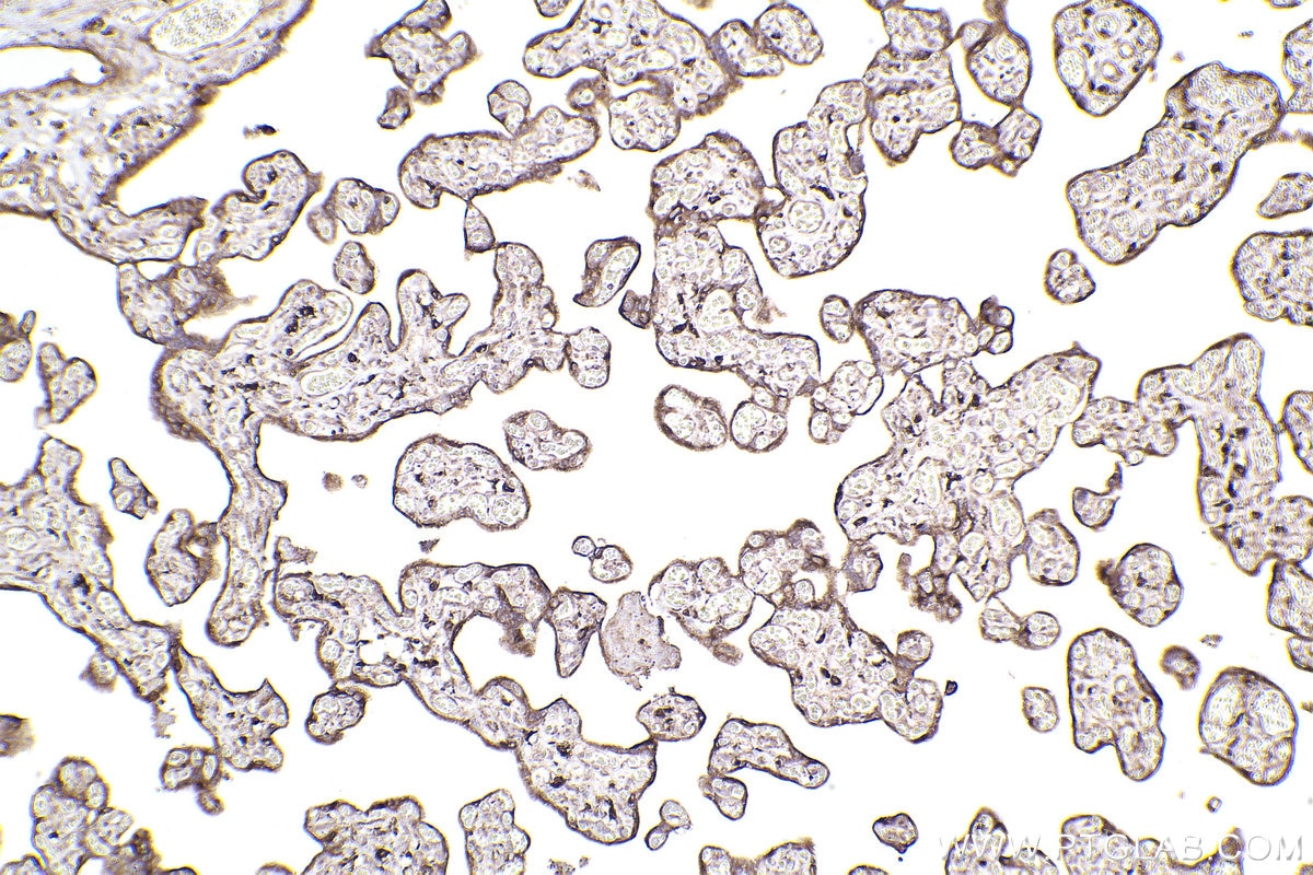 Immunohistochemistry (IHC) staining of human placenta tissue using RAB31 Polyclonal antibody (15485-1-AP)