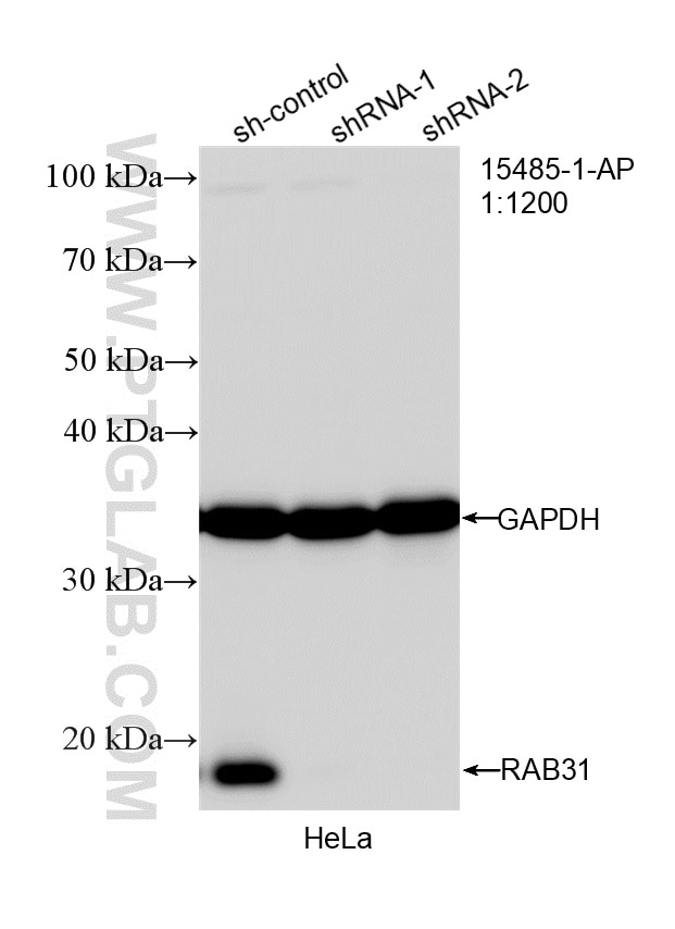 Western Blot (WB) analysis of HeLa cells using RAB31 Polyclonal antibody (15485-1-AP)