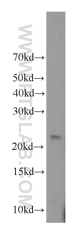 Western Blot (WB) analysis of human placenta tissue using RAB31 Polyclonal antibody (15485-1-AP)