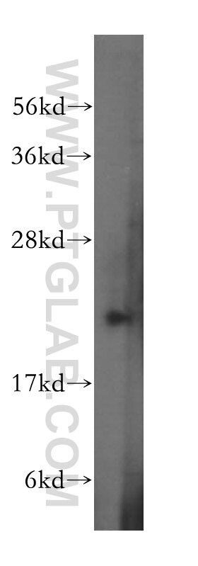 Western Blot (WB) analysis of human placenta tissue using RAB31 Polyclonal antibody (15485-1-AP)