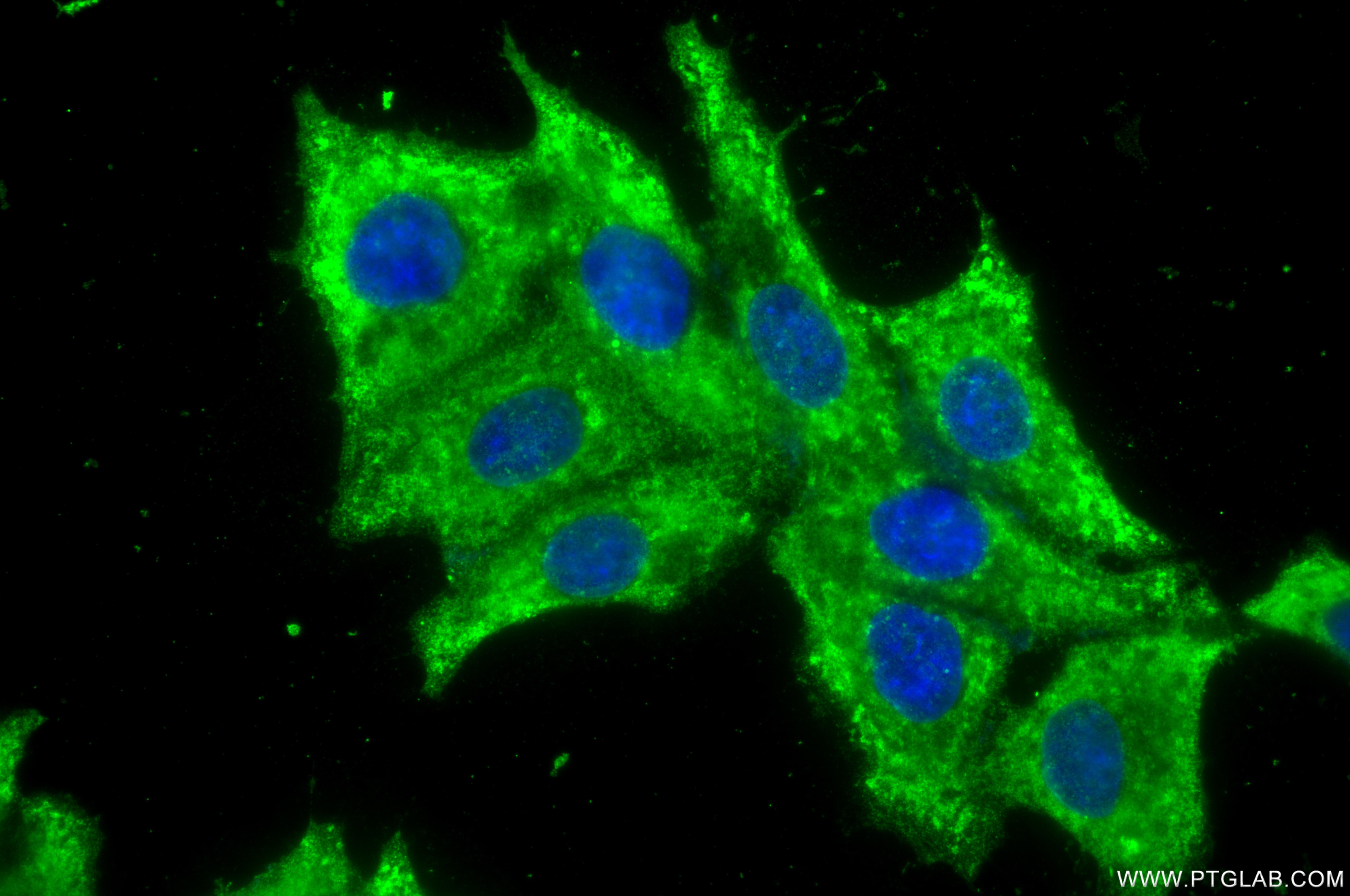 Immunofluorescence (IF) / fluorescent staining of HepG2 cells using RAB31 Recombinant monoclonal antibody (83434-2-RR)