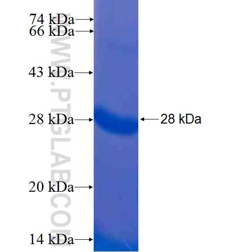 RAB31 fusion protein Ag7759 SDS-PAGE