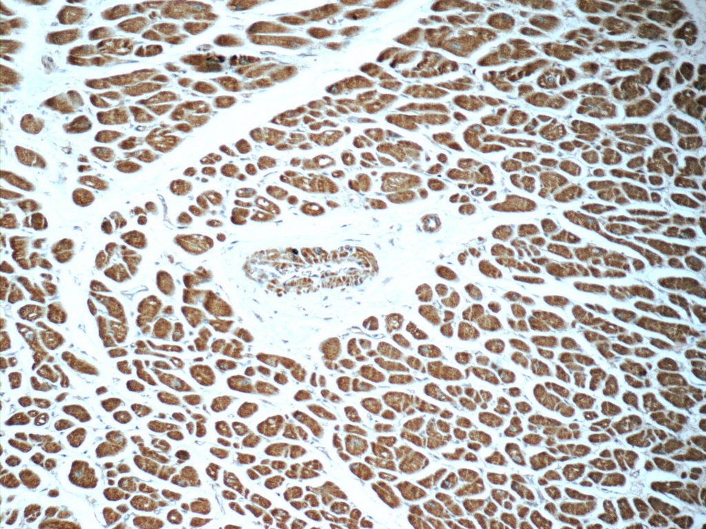 IHC staining of human heart using 16182-1-AP
