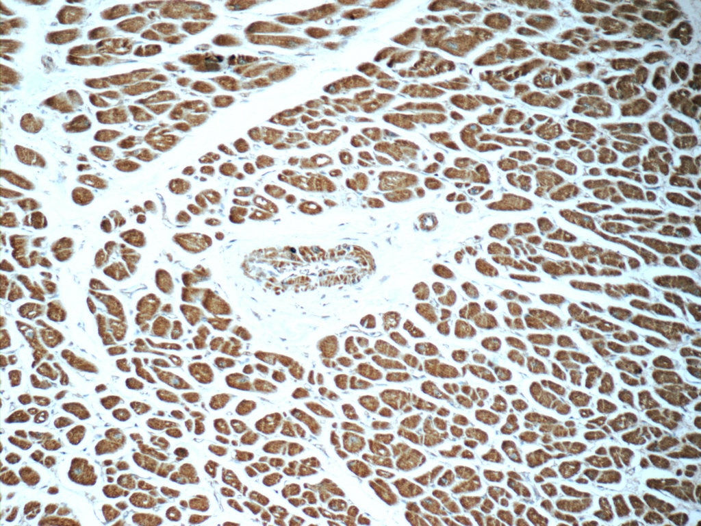 Immunohistochemistry (IHC) staining of human heart tissue using RAB31-specific Polyclonal antibody (16182-1-AP)