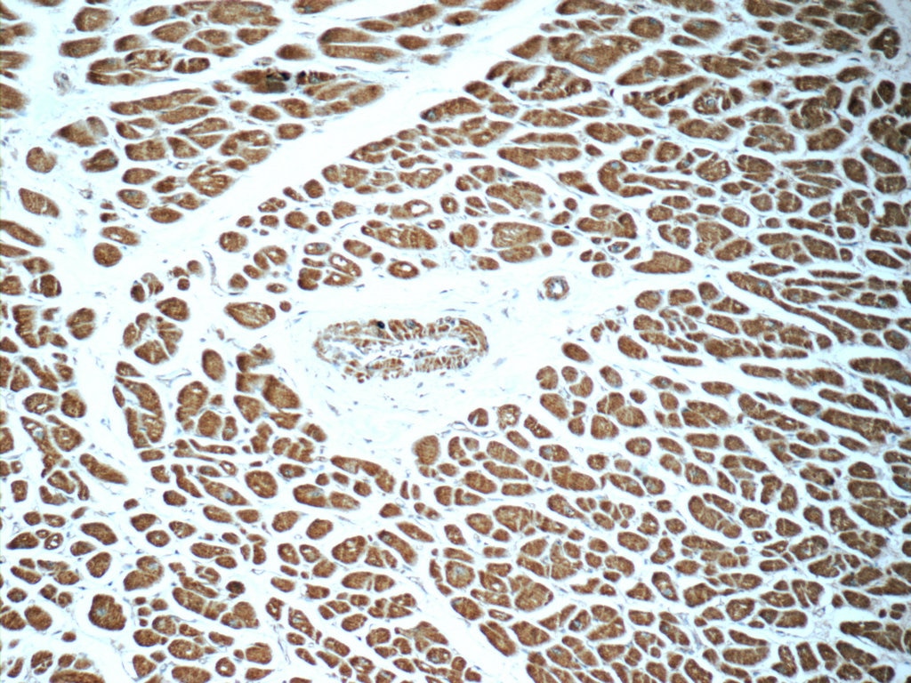 Immunohistochemistry (IHC) staining of human heart tissue using RAB31-specific Polyclonal antibody (16182-1-AP)