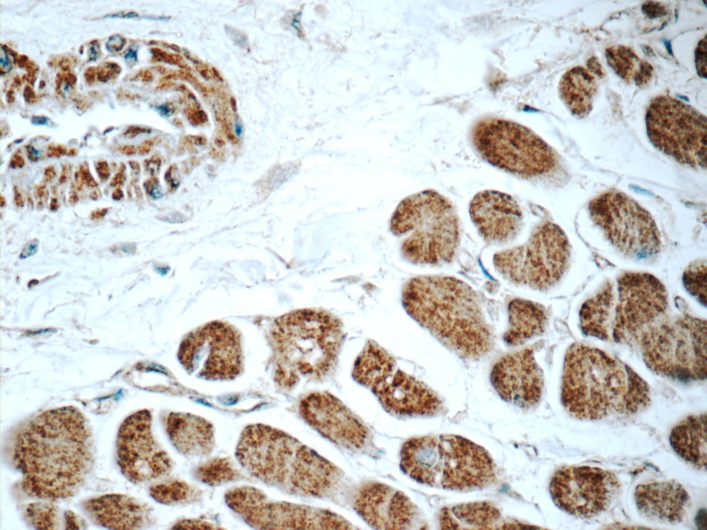 Immunohistochemistry (IHC) staining of human heart tissue using RAB31-specific Polyclonal antibody (16182-1-AP)