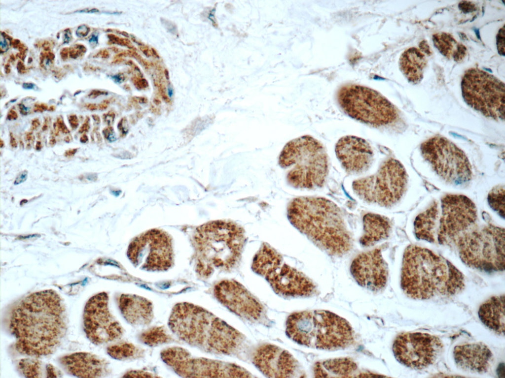 IHC staining of human heart using 16182-1-AP