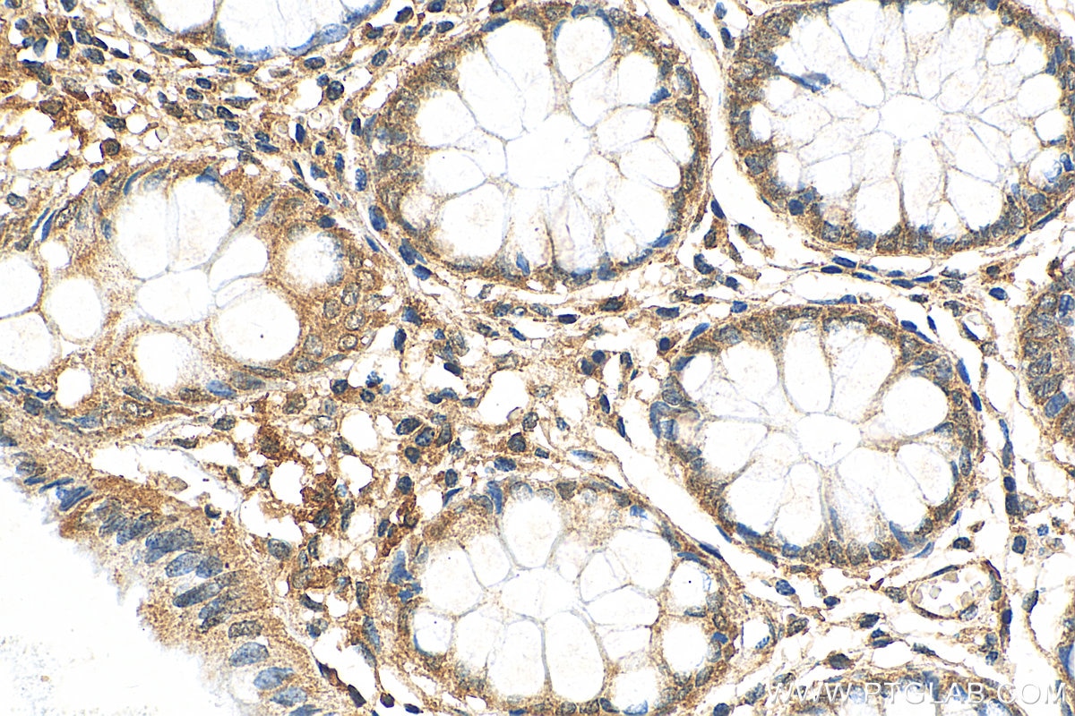 Immunohistochemistry (IHC) staining of human colon tissue using RAB31-specific Polyclonal antibody (16182-1-AP)