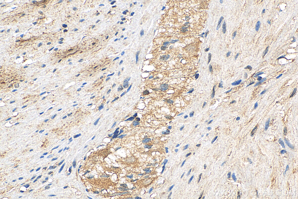 Immunohistochemistry (IHC) staining of human colon tissue using RAB31-specific Polyclonal antibody (16182-1-AP)