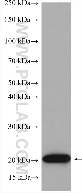 Western Blot (WB) analysis of HeLa cells using RAB31-specific Polyclonal antibody (16182-1-AP)