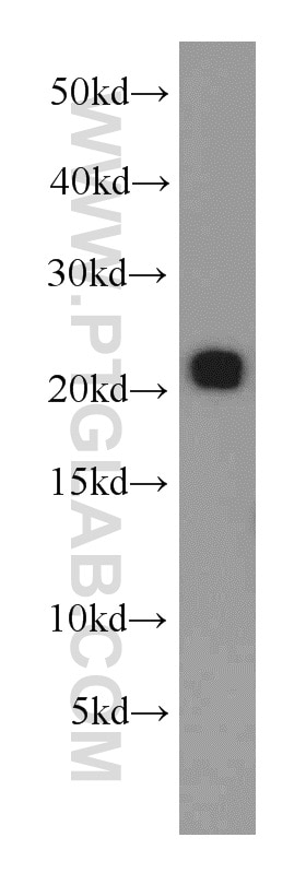 Western Blot (WB) analysis of human brain tissue using RAB31-specific Polyclonal antibody (16182-1-AP)