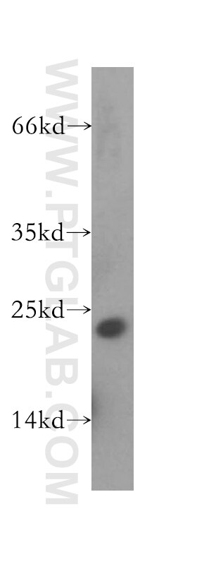 Western Blot (WB) analysis of human brain tissue using RAB31-specific Polyclonal antibody (16182-1-AP)