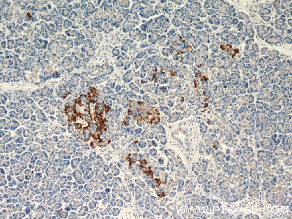 Immunohistochemistry (IHC) staining of human pancreas tissue using RAB31-specific Monoclonal antibody (60146-1-Ig)