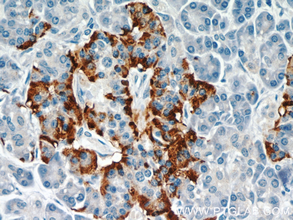 Immunohistochemistry (IHC) staining of human pancreas tissue using RAB31-specific Monoclonal antibody (60146-1-Ig)