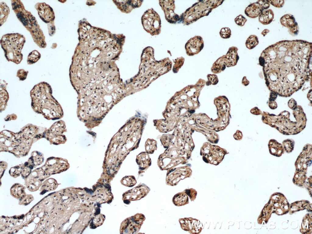 Immunohistochemistry (IHC) staining of human placenta tissue using RAB31-specific Monoclonal antibody (60146-1-Ig)