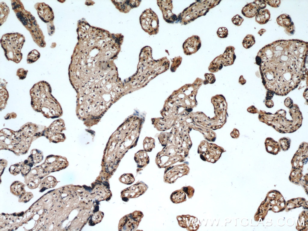 IHC staining of human placenta using 60146-1-Ig