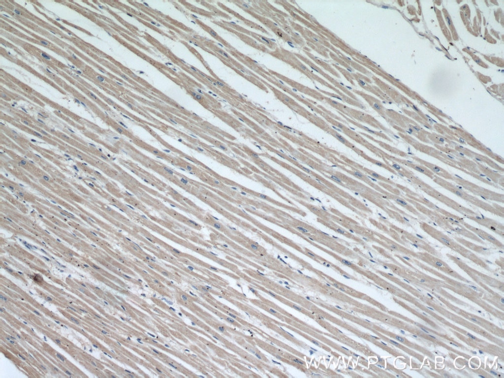 Immunohistochemistry (IHC) staining of human heart tissue using RAB31-specific Monoclonal antibody (60146-1-Ig)