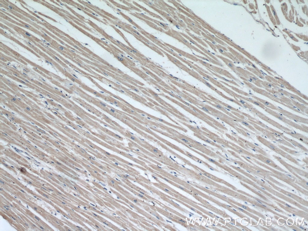 IHC staining of human heart using 60146-1-Ig