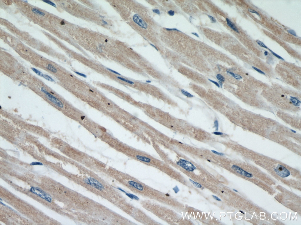 IHC staining of human heart using 60146-1-Ig