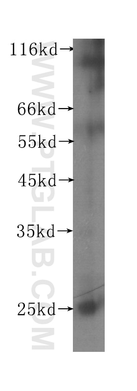 Western Blot (WB) analysis of mouse colon tissue using RAB31-specific Monoclonal antibody (60146-1-Ig)
