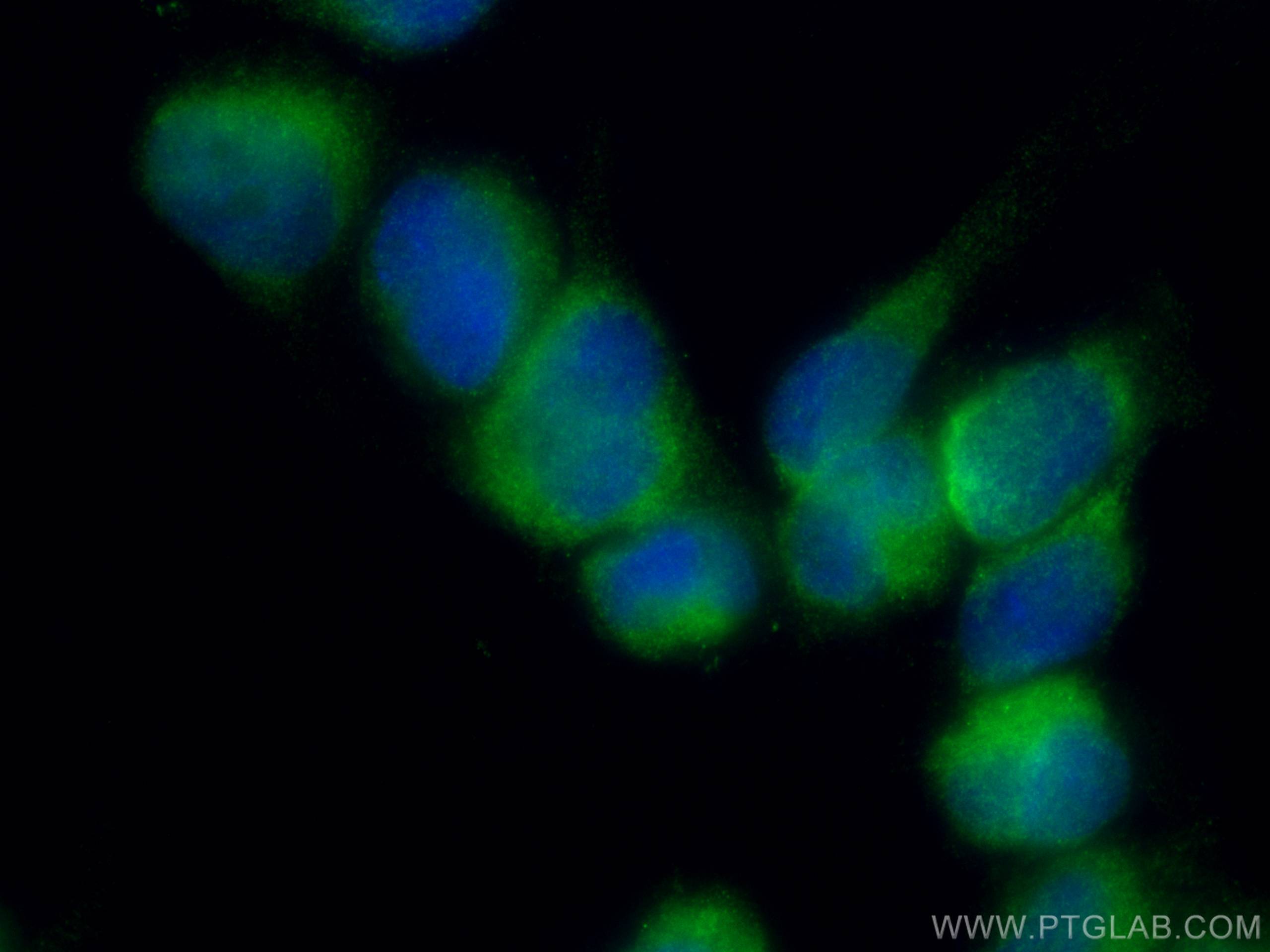 Immunofluorescence (IF) / fluorescent staining of U-251 cells using RAB32 Polyclonal antibody (10999-1-AP)