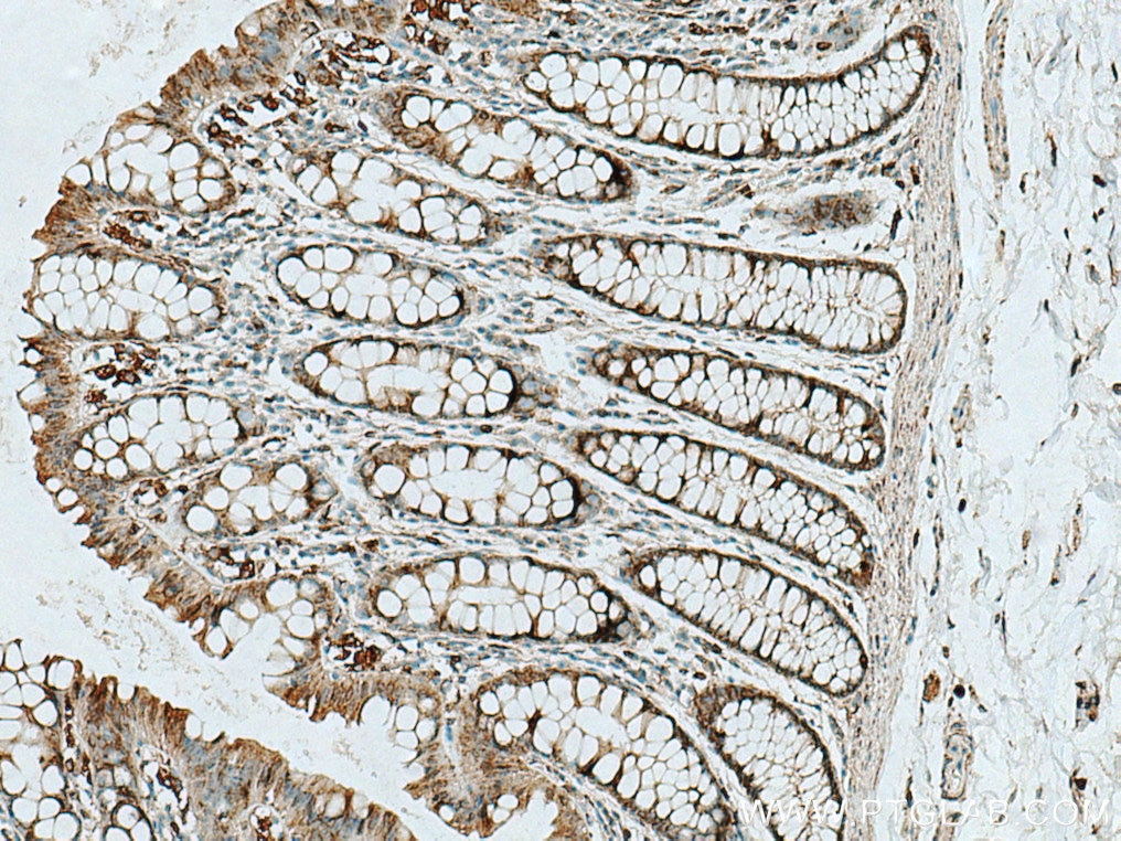 Immunohistochemistry (IHC) staining of human colon tissue using RAB32 Polyclonal antibody (10999-1-AP)
