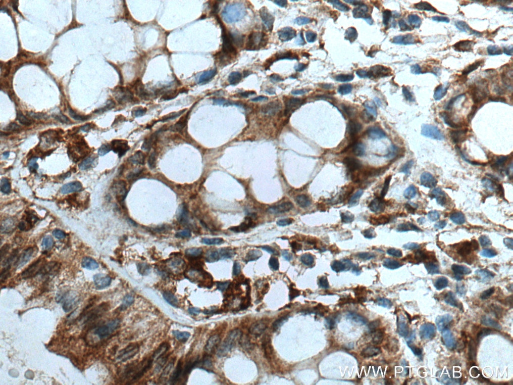 Immunohistochemistry (IHC) staining of human colon tissue using RAB32 Polyclonal antibody (10999-1-AP)