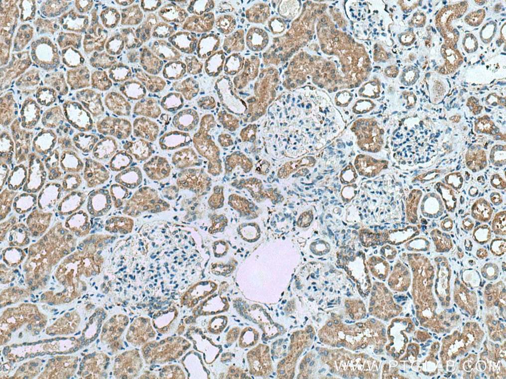 Immunohistochemistry (IHC) staining of human kidney tissue using RAB32 Polyclonal antibody (10999-1-AP)