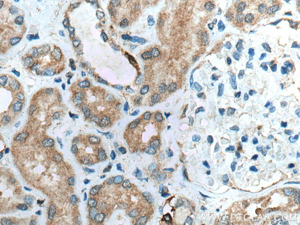 Immunohistochemistry (IHC) staining of human kidney tissue using RAB32 Polyclonal antibody (10999-1-AP)