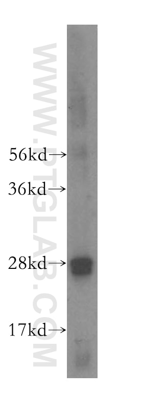 Western Blot (WB) analysis of human colon tissue using RAB32 Polyclonal antibody (10999-1-AP)