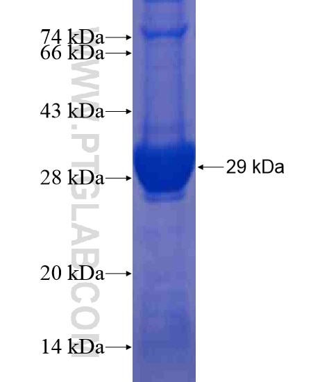RAB32 fusion protein Ag21285 SDS-PAGE
