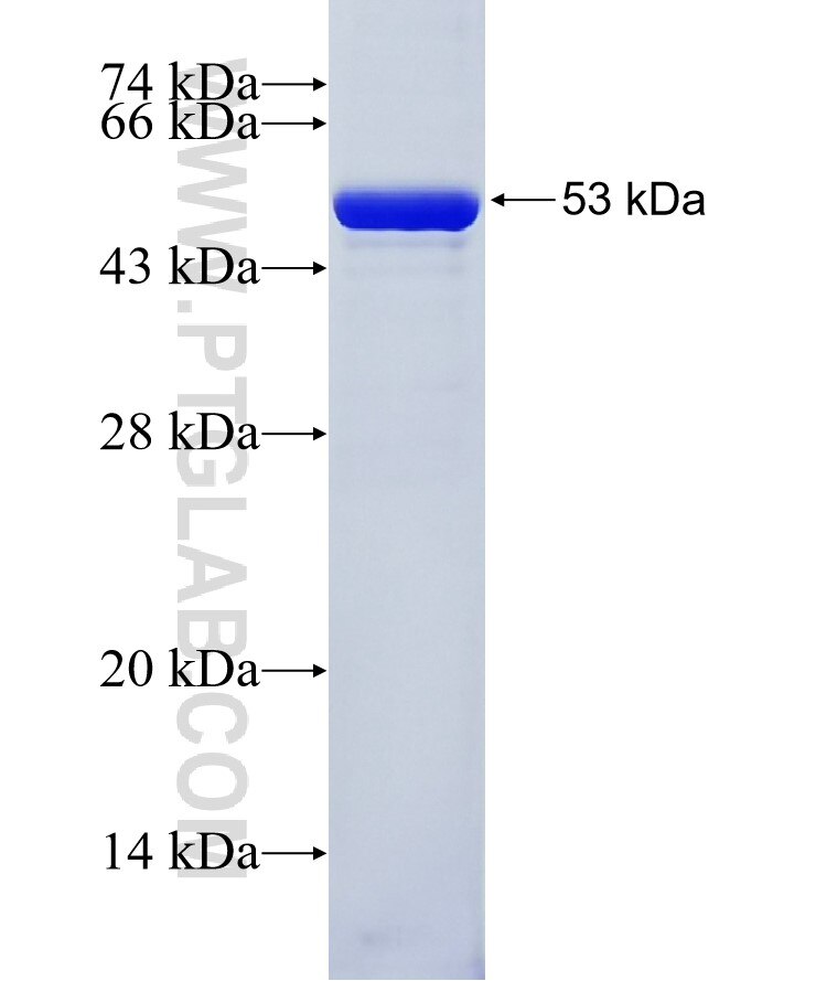 RAB32 fusion protein Ag1450 SDS-PAGE