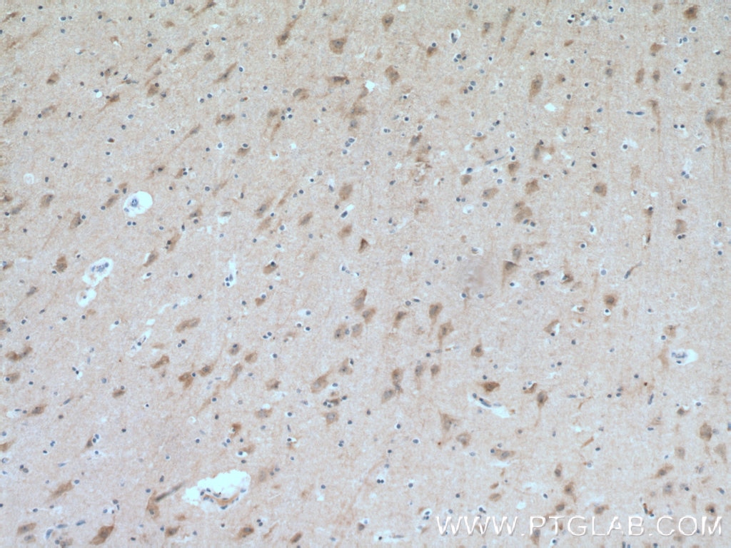 Immunohistochemistry (IHC) staining of human brain tissue using RAB33A Polyclonal antibody (11025-1-AP)