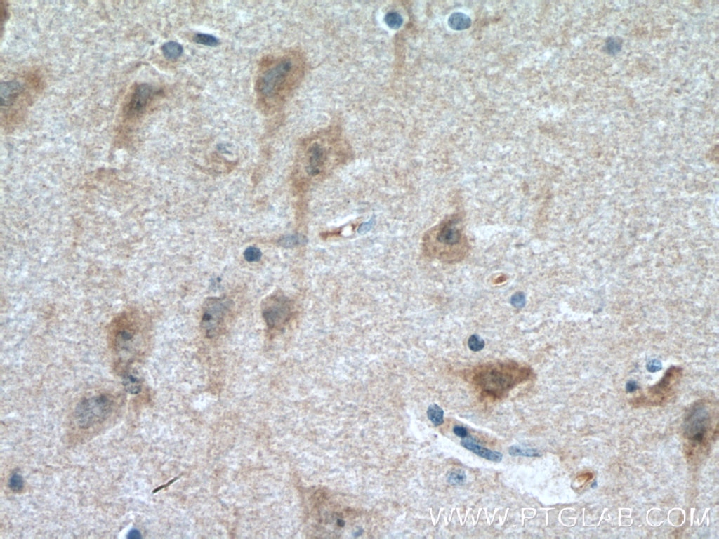 Immunohistochemistry (IHC) staining of human brain tissue using RAB33A Polyclonal antibody (11025-1-AP)