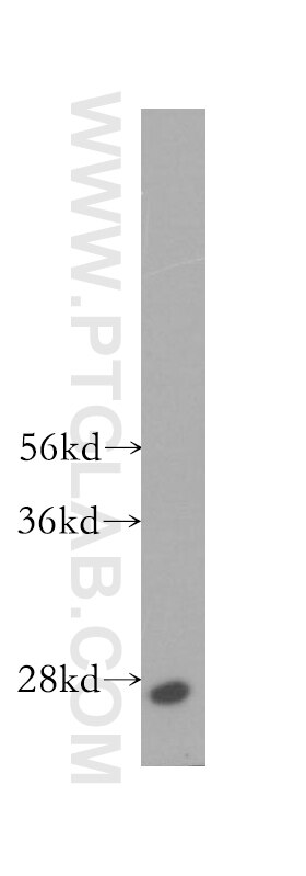 Western Blot (WB) analysis of human brain tissue using RAB33A Polyclonal antibody (11025-1-AP)