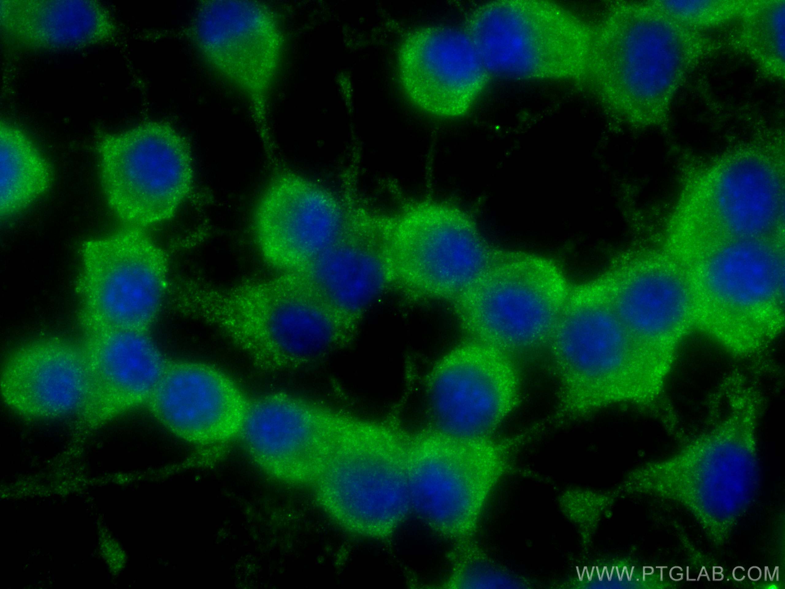 Immunofluorescence (IF) / fluorescent staining of Neuro-2a cells using RAB33A Monoclonal antibody (68389-1-Ig)