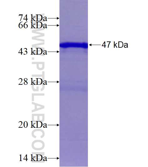 RAB33A fusion protein Ag1492 SDS-PAGE