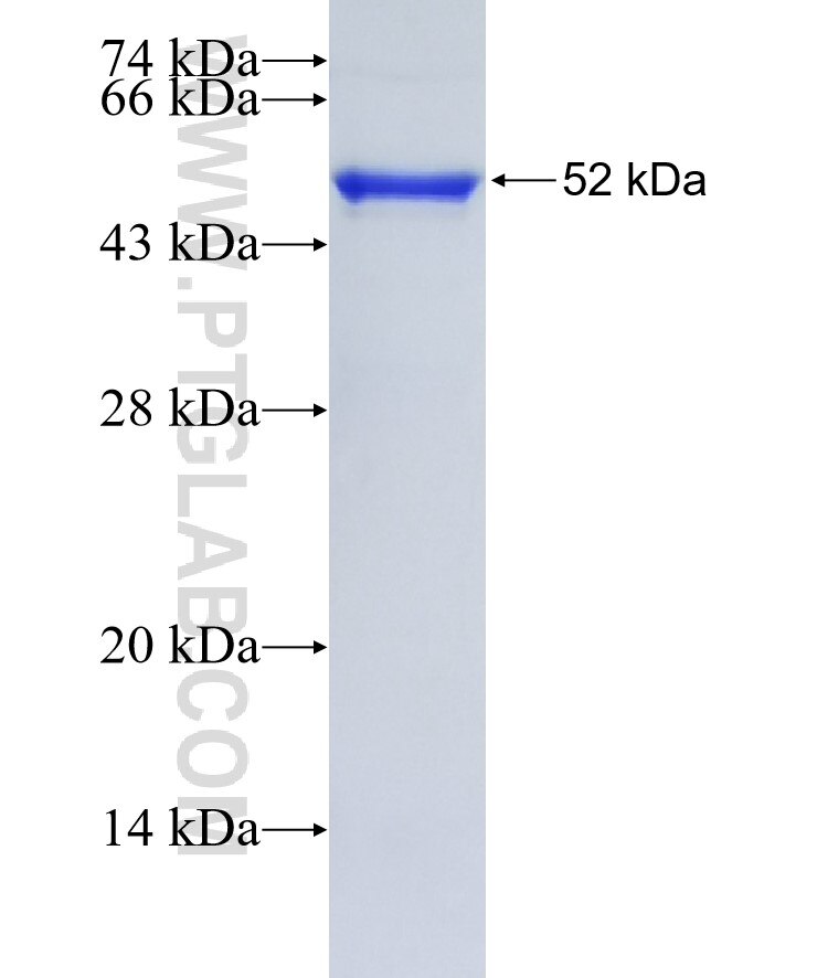 RAB33B fusion protein Ag11886 SDS-PAGE
