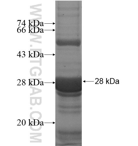 RAB33B fusion protein Ag12153 SDS-PAGE