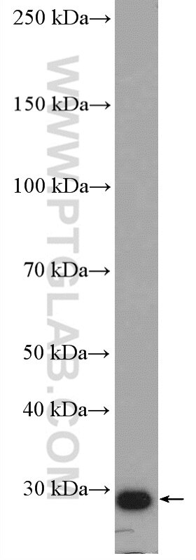 Western Blot (WB) analysis of HeLa cells using RAB34 Polyclonal antibody (27435-1-AP)