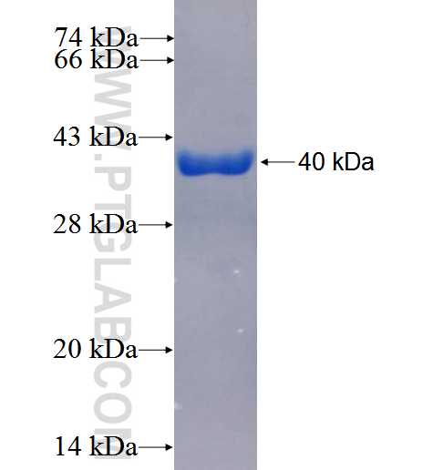 RAB34 fusion protein Ag26696 SDS-PAGE