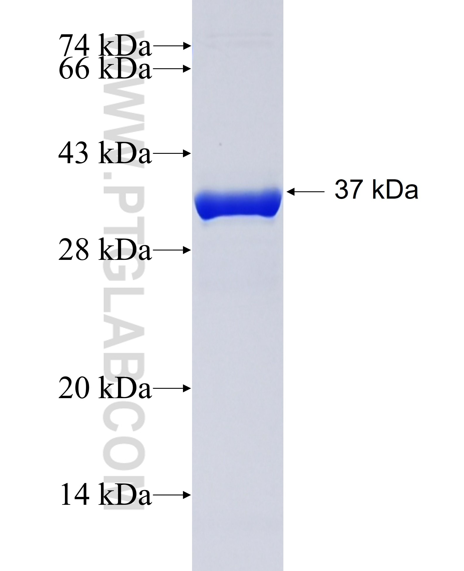 RAB34 fusion protein Ag26696 SDS-PAGE