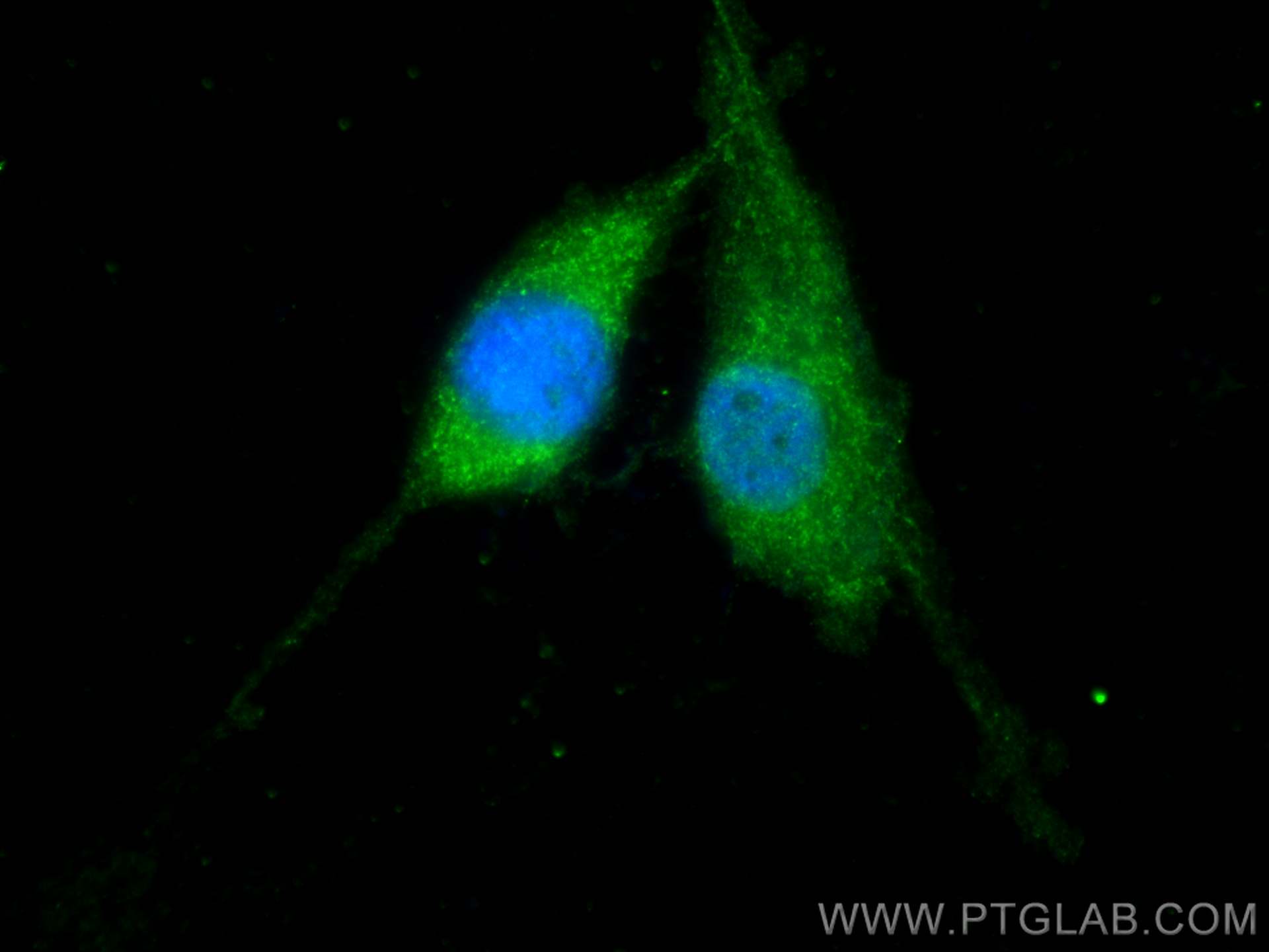 Immunofluorescence (IF) / fluorescent staining of U-87 MG cells using RAB35 Polyclonal antibody (11329-2-AP)