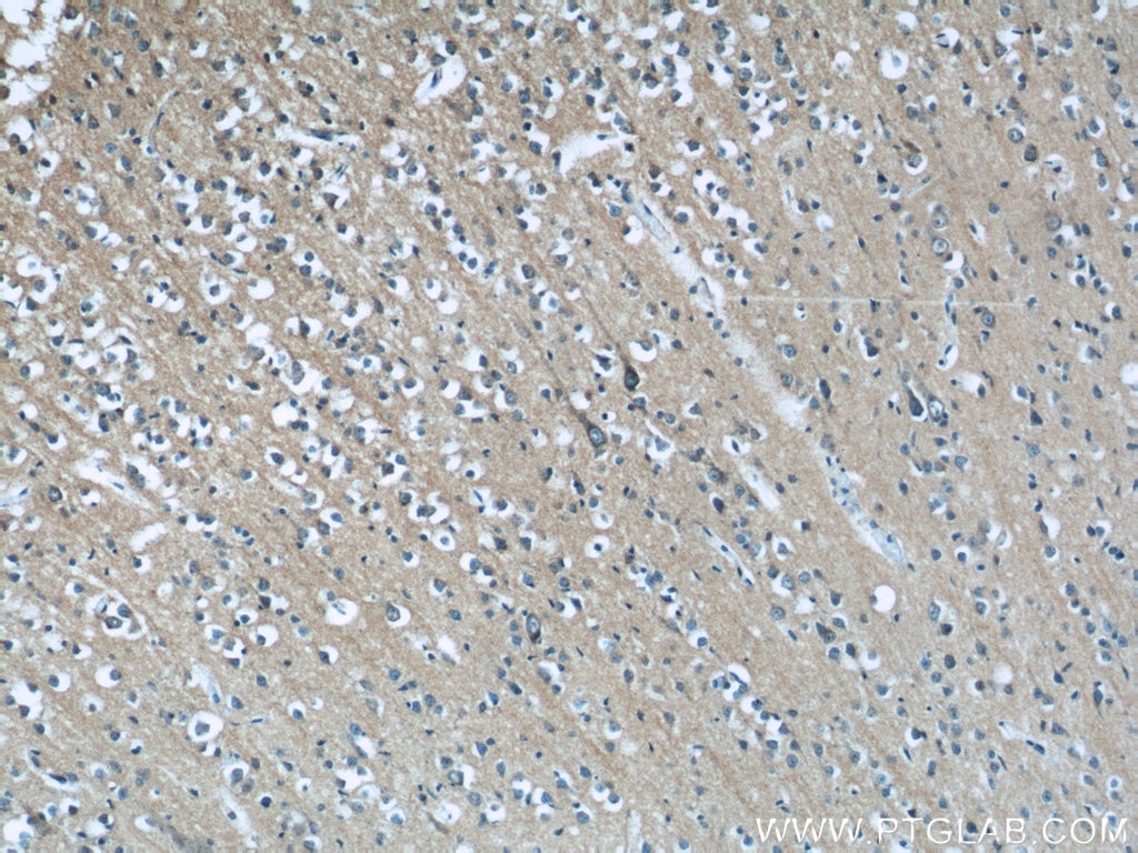 Immunohistochemistry (IHC) staining of human brain tissue using RAB35 Polyclonal antibody (11329-2-AP)