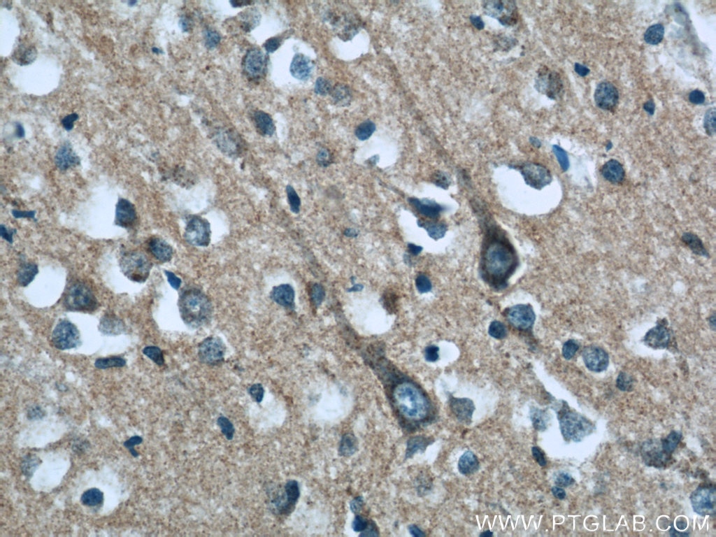 Immunohistochemistry (IHC) staining of human brain tissue using RAB35 Polyclonal antibody (11329-2-AP)