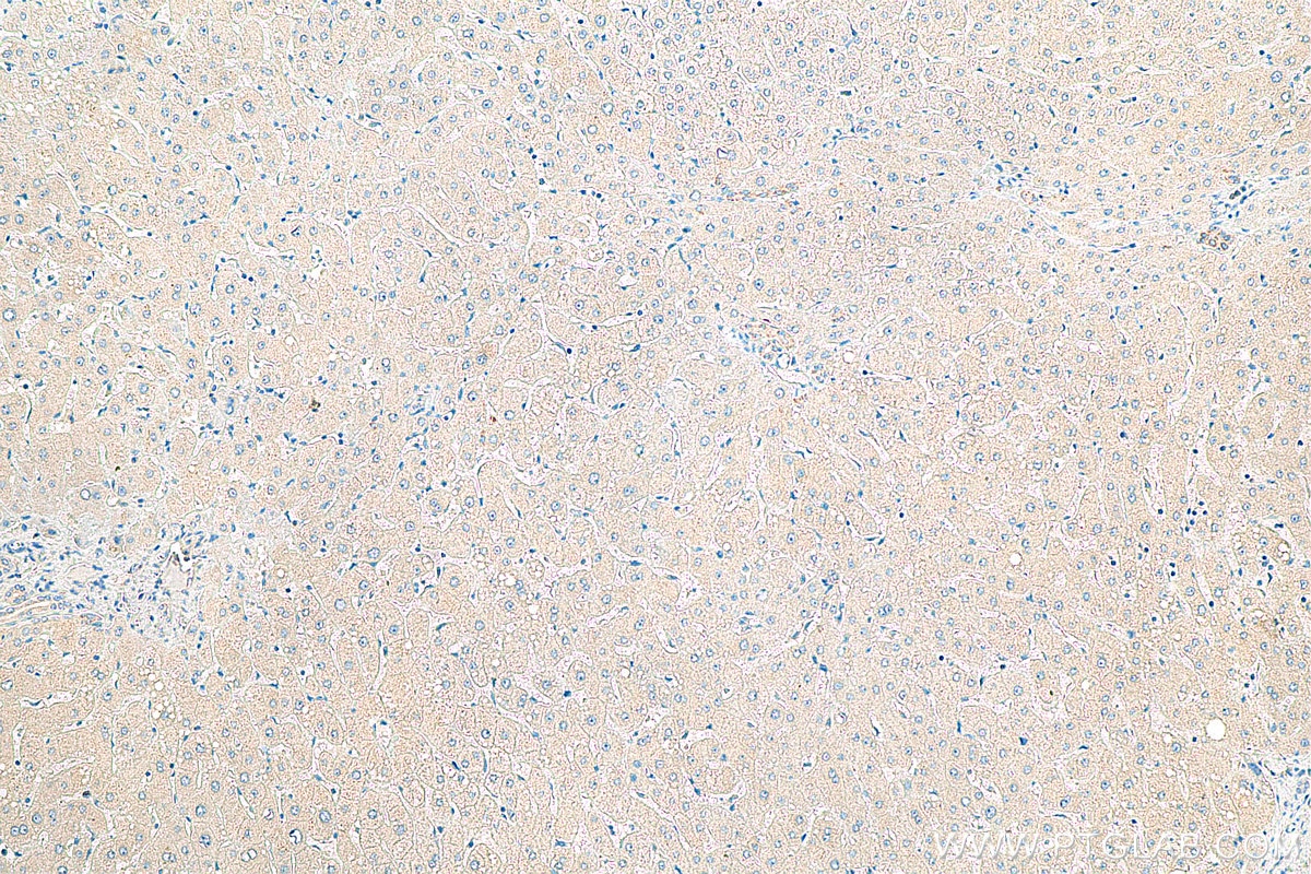 Immunohistochemistry (IHC) staining of human liver tissue using RAB35 Polyclonal antibody (11329-2-AP)