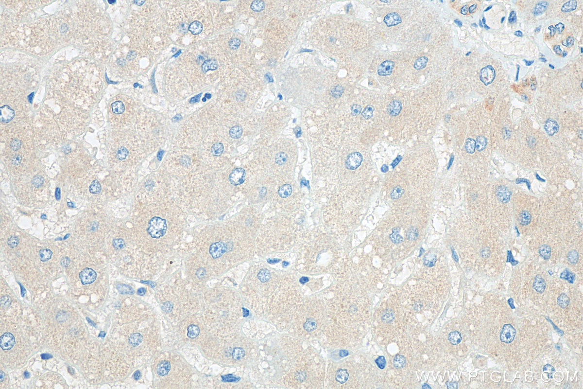 Immunohistochemistry (IHC) staining of human liver tissue using RAB35 Polyclonal antibody (11329-2-AP)